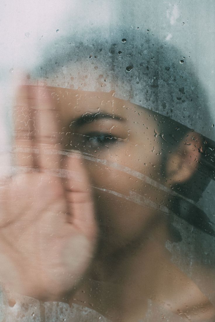 Fettige Kopfhaut bei androgenetischem Haarausfall